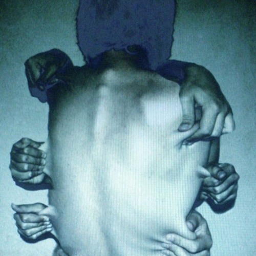 Infection