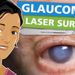 Best Glaucoma Eye Laser Treatment Reviews