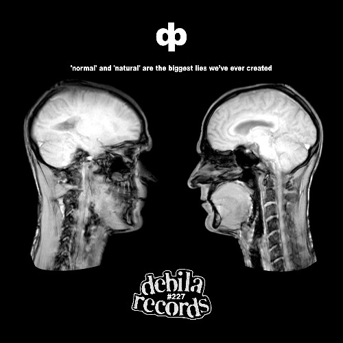 sick society - xcerpt