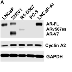Targeting PCNA-Androgen Receptor Interaction Suppresses Prostate Cancer Cell Growth