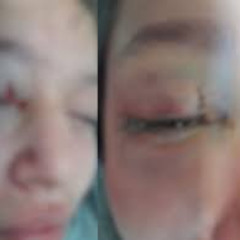 Trending]: Briga Entre Alunas Termina Com Golpes De Tesoura Portal Zacarias