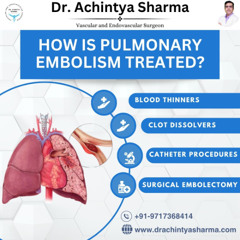 Rising Pulmonary Thromboembolism Cases in India Alarming Trends