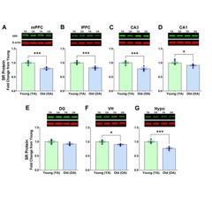 Serine Racemase Expression in the Brain During Aging in Male and Female Rats