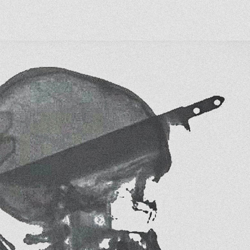 x-ray