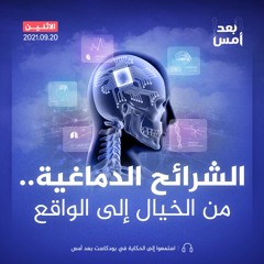 الشرائح الدماغية.. من الخيال إلى الواقع