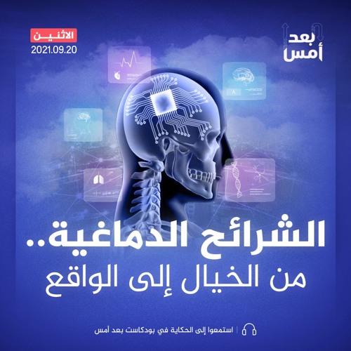 الشرائح الدماغية.. من الخيال إلى الواقع