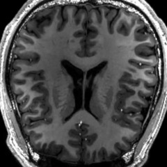 Medical Psy Protocol