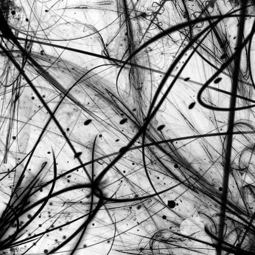 Nematomorpha - We Fell Your Pain