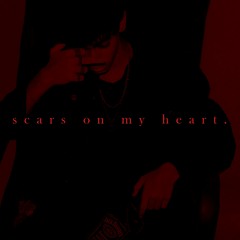 scars on my heart.