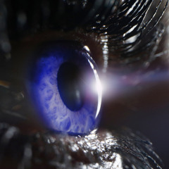 Episode #139 - Glaucoma: Setting Sights on Improving Outcomes