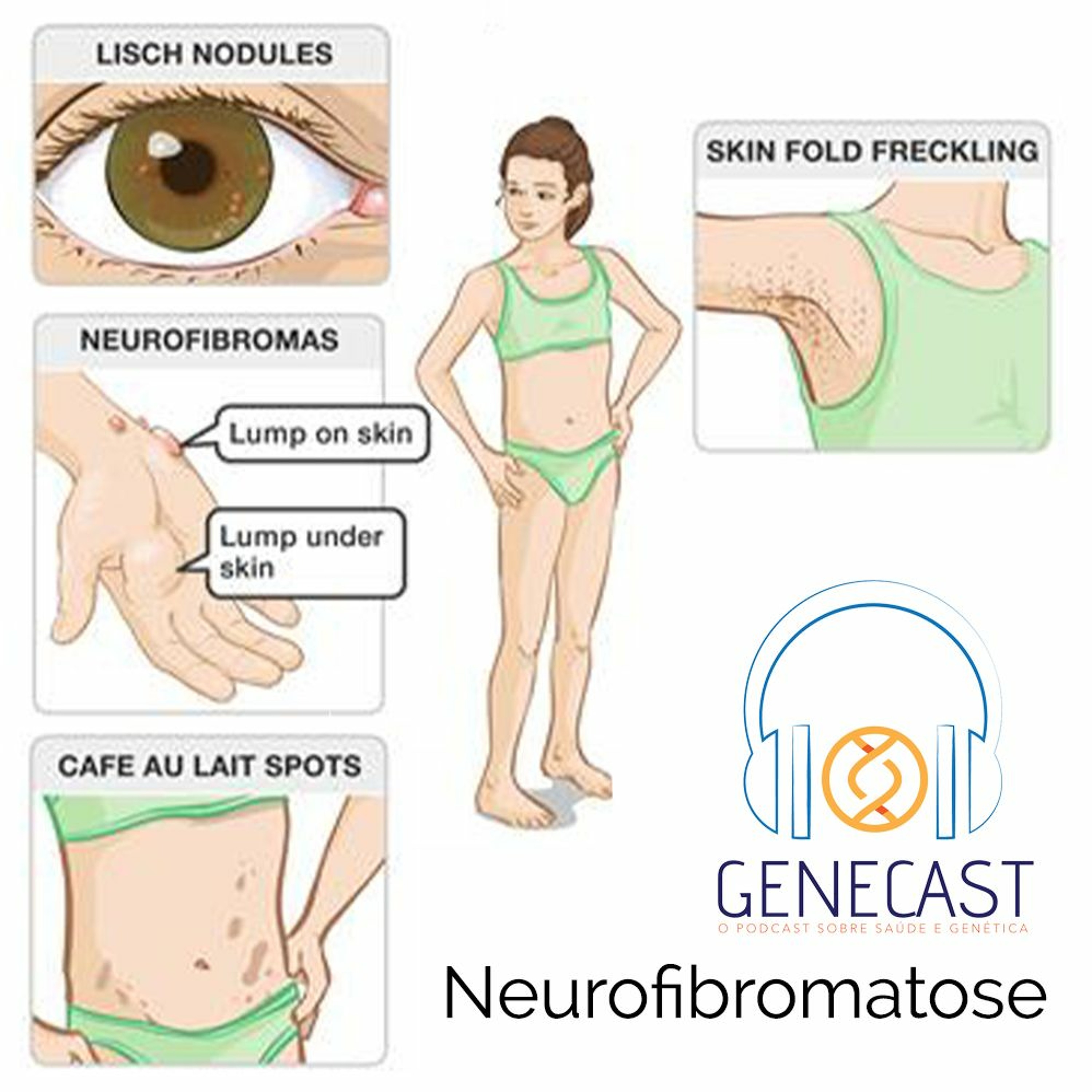 Genecast