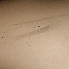 Scars he said were ours