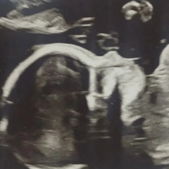 Little Fighter