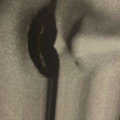 Melting point