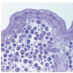 Osmoza Difuza