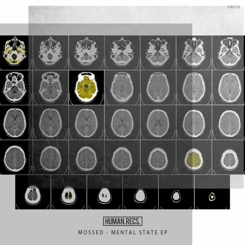 Preview / Mossed - Mental State EP / [HR010]