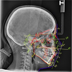 Anas Hefny Tamol انس حفني تامول