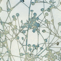 231106 Long Walks And Bruises