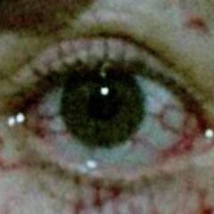 BLOODSHOT