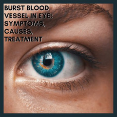 Best Blood Vessel In Eye Treatment Reviews