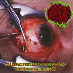 OCULAR×EXPULSION×OF×EMETIC×MATERIAL (lo-fi raw version)