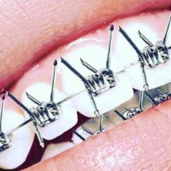 $UICIDEBOY$ & BONES - DeadmanVenom (feat. Shakewell)