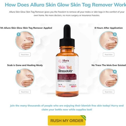 Allura Skin Tag Remover Reviews Consumer Reports Stream Allura Skin Glow Skin Tag Remover DOES IT REALLY WORK? CLIENTS