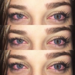 Low Eyes