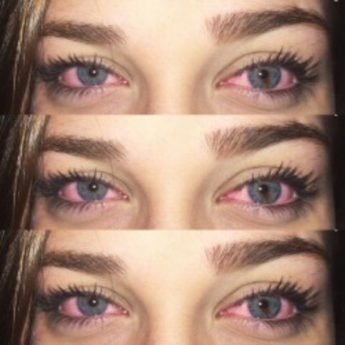 Low Eyes