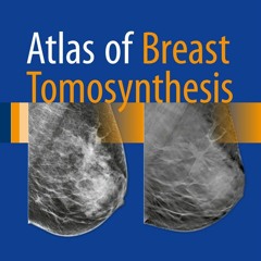 [READ]- Atlas of Breast Tomosynthesis: Imaging Findings and Image-Guided Interventions