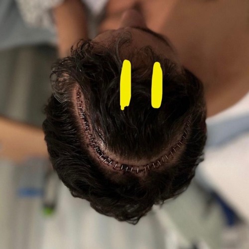 MIKE WALLIS - HAPPY DAYS (2025) POST MIX (Post Surgery)