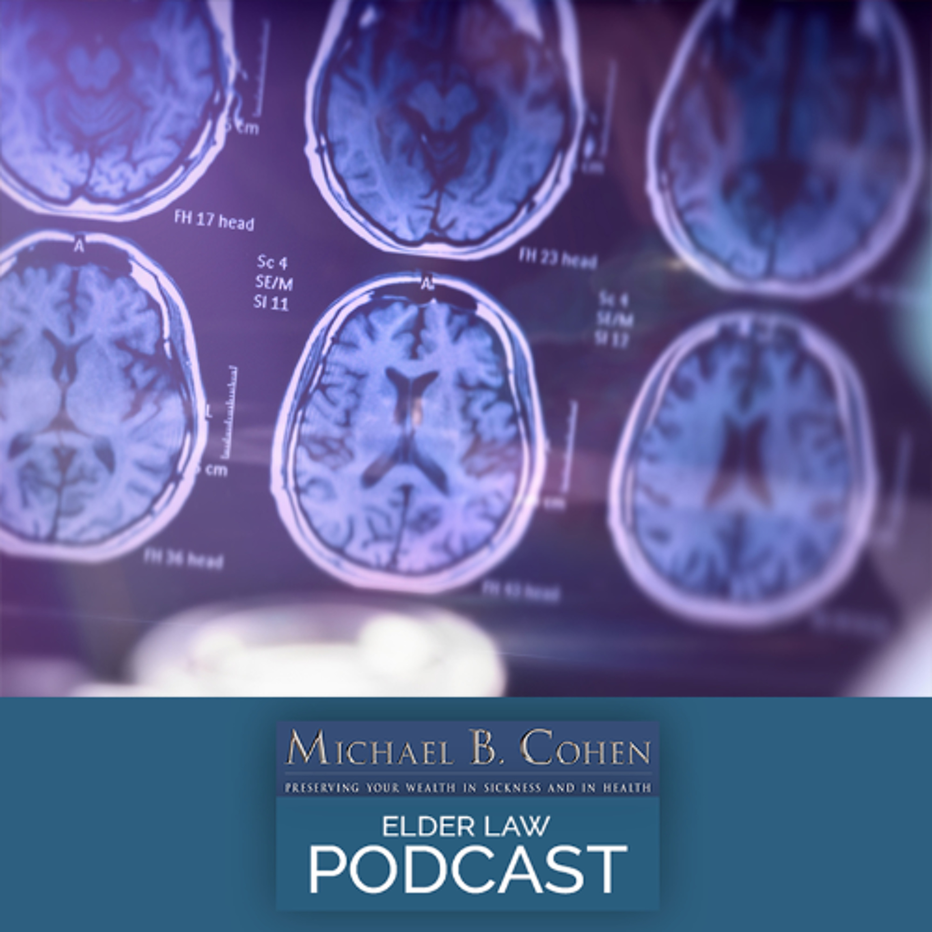 FDA Approves Blood Test to Diagnose Alzheimer's episode artwork