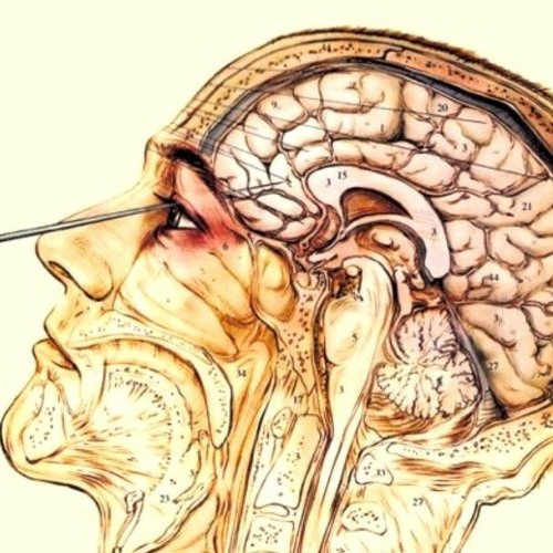 Lobotomy Type Beat