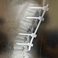 4 Day1 ft 404gohstboy