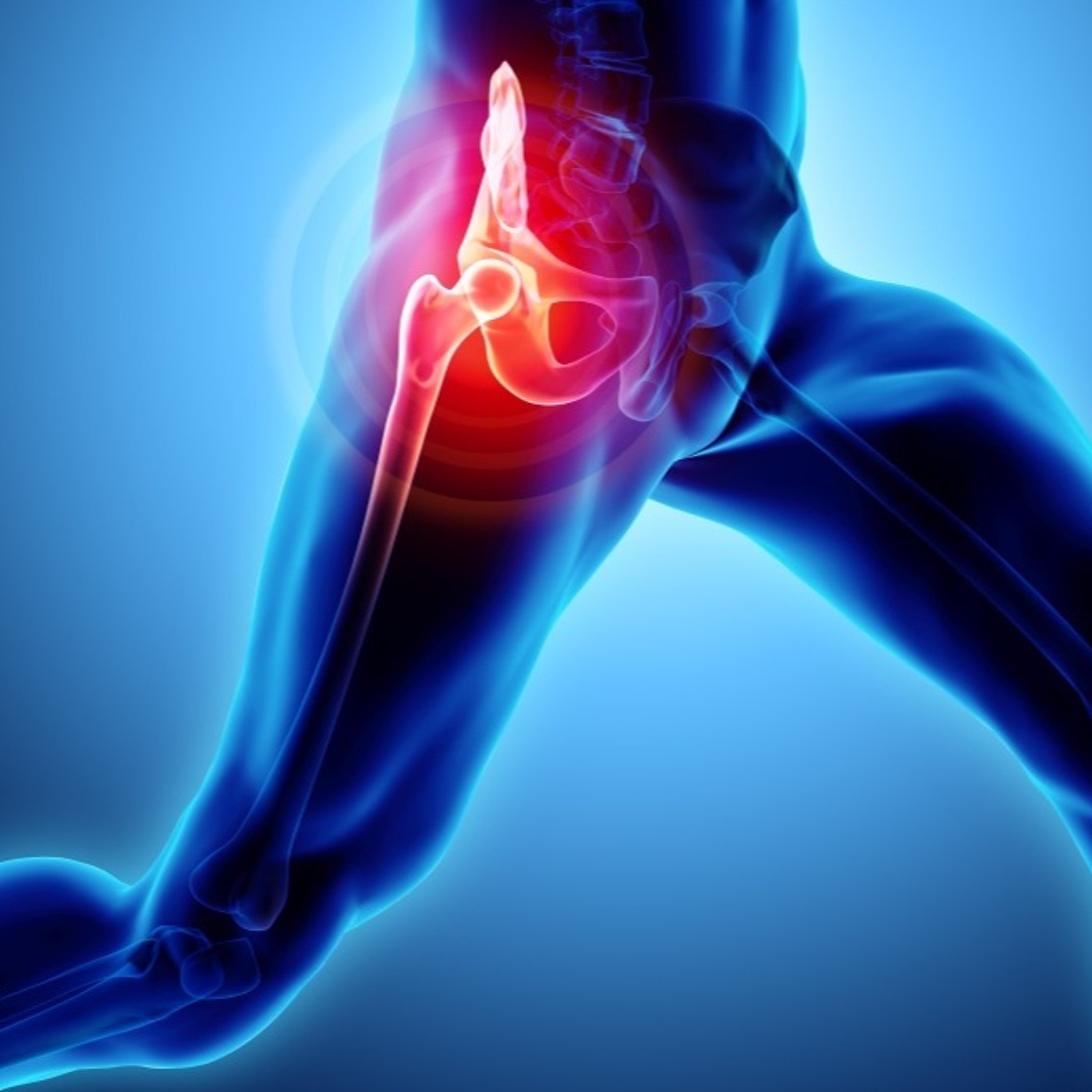 Hip injuries? Connor and Michael go through the major and minors!