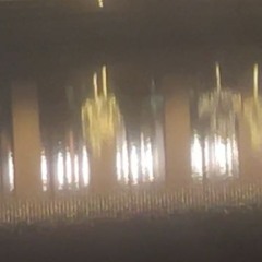 Too Many Thoughts 💔