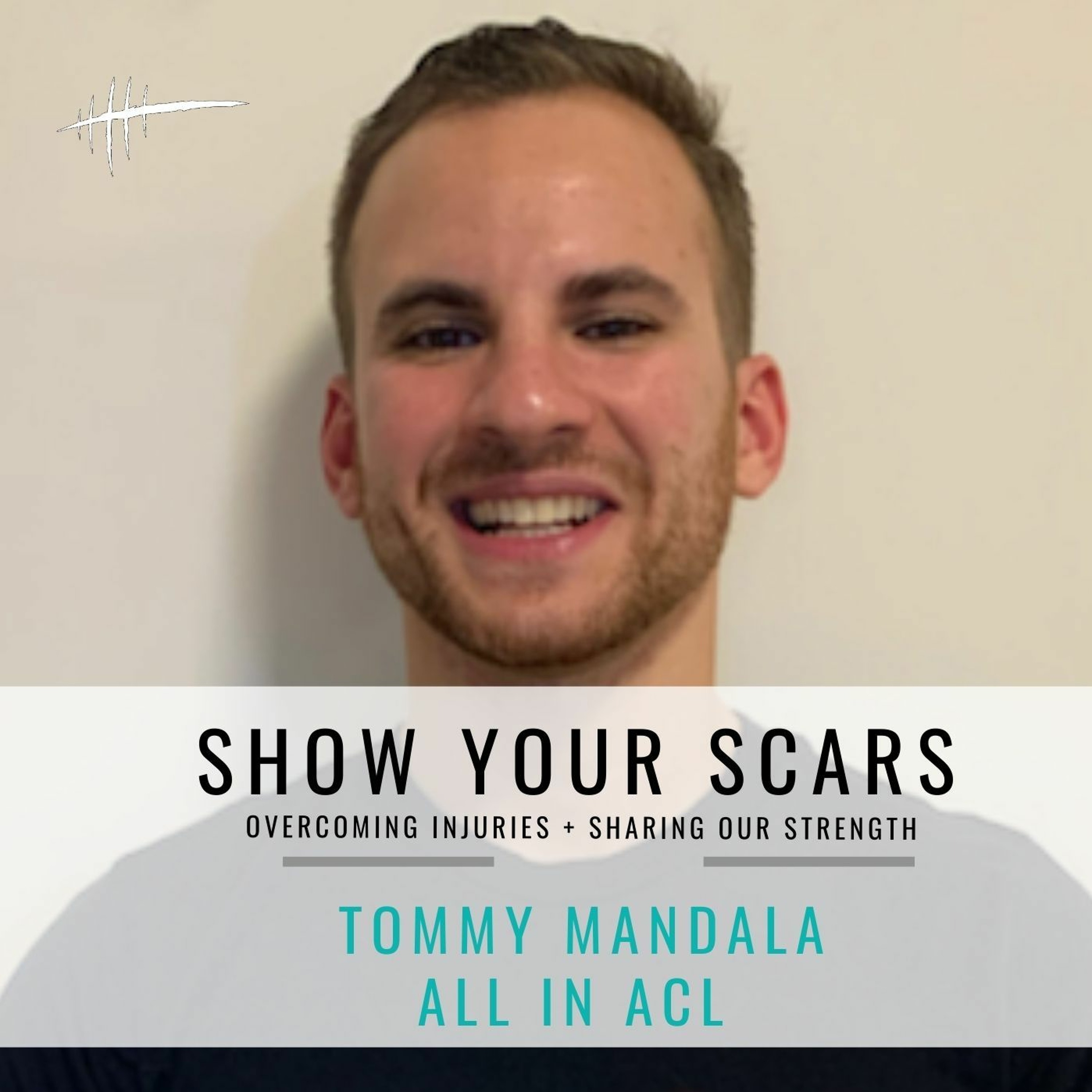 Show Your Scars