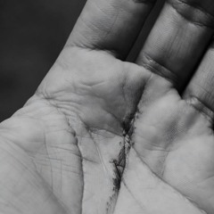 Scars