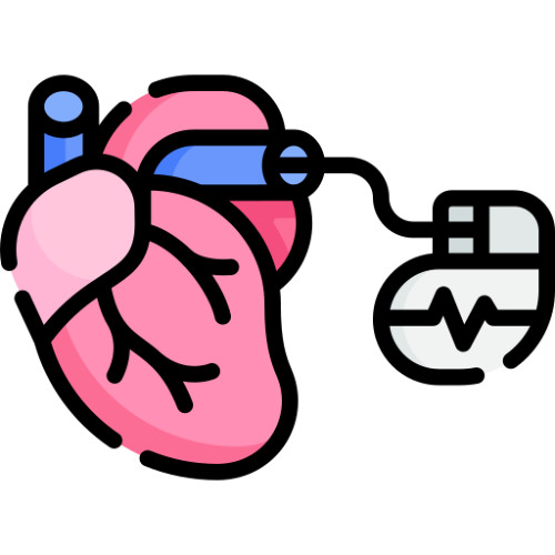 Pacemaker FR