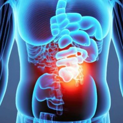 Gastric Re - Flux