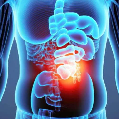 Gastric Re - Flux