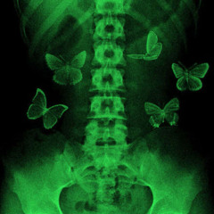 4xlowkey - watch yo back ft gooli (prod. onehotnife) [TAKEYOGAT + CUTECAUCASIANGK EXCLUSIVE]