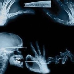 HEADLOXK (Street Prophet)