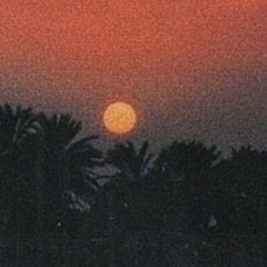 Sunburn