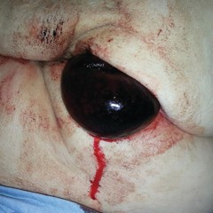 Dj Comrie - Serious Prolapse Inbound!!!