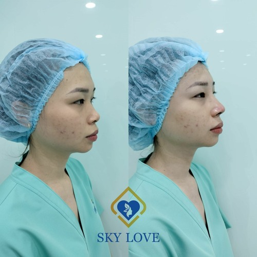 Mũi Sư Tử Là Gì? Khám Phá Đặc Điểm, Ý Nghĩa và Ứng Dụng Của Mũi Sư Tử