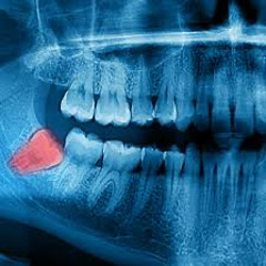 TOOTHACHE!