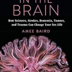 [View] PDF 📋 Sex in the Brain: How Seizures, Strokes, Dementia, Tumors, and Trauma C