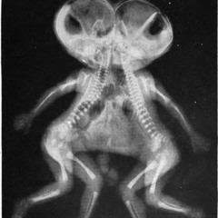 Recently Unconjoined