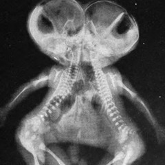 The Correct Way To Spell Potato